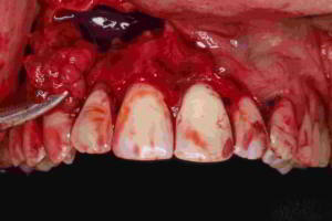 aacib-galeria-002 aacib-galeria-002