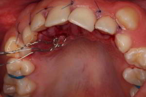 aacib-galeria-004 aacib-galeria-004