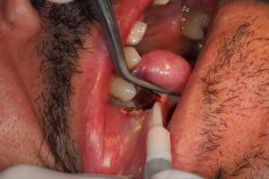 aacib-galeria-005 aacib-galeria-005