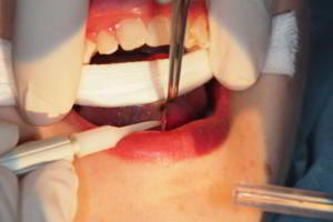 aacib-galeria-007 aacib-galeria-007