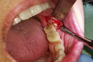 aacib-galeria-008 aacib-galeria-008