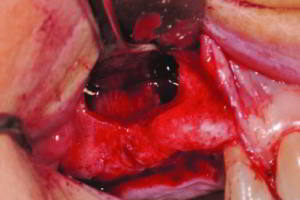 aacib-galeria-010 aacib-galeria-010