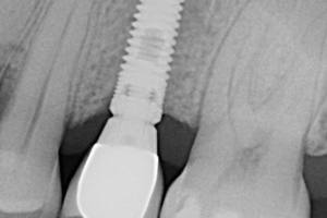 aacib-galeria-011 aacib-galeria-011