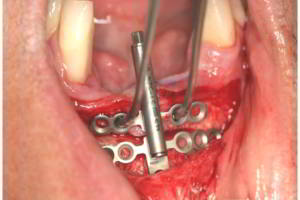 aacib-galeria-016 aacib-galeria-016