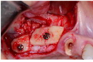 aacib-galeria-017 aacib-galeria-017