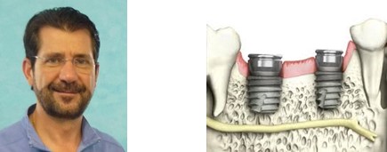 curso-implantes-cortos-huelva-aacib