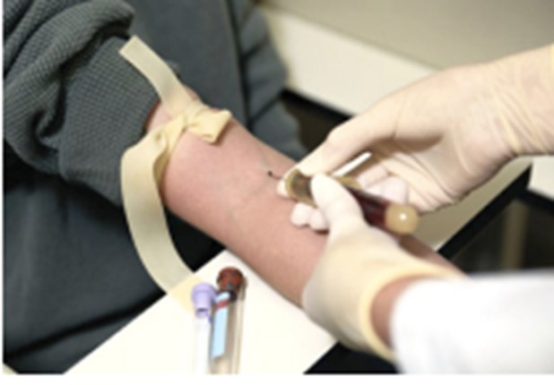 curso-tecnica-venopuncion-odontologia-sevilla curso-tecnica-venopuncion-odontologia-sevilla-aacib