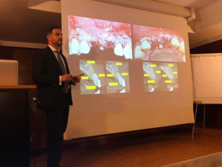 noticia-cuso-actualizacion-biologia-seno-maxilar